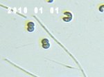 Kirchneriella (Hörnchen) + Chroococcus .jpg